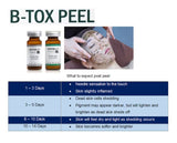 Matrigen B-Tox Peel (Herbal Peel/No Needle)