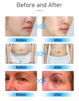 9in1 - Ultrasonic Cavitation & Slimming Machine (80khz)