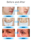 9in1 - Ultrasonic Cavitation & Slimming Machine (80khz)