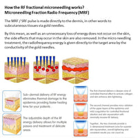 Fractional RF Microneedling Machine (SAHPRA Approved)