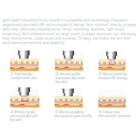 Fractional RF Microneedling Machine (SAHPRA Approved)