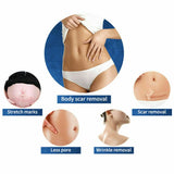 Fractional RF Microneedling Machine (SAHPRA Approved)