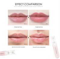 Serum Release Microneedling Roller (0.25mm)