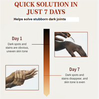 Dark Knuckle Removal Serum (50ml)