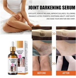 Dark Knuckle Removal Serum (50ml)