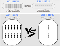 6D HIFU Machine (Pre-Owned)