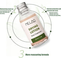 Acne Drying Lotion - Spot Treatment