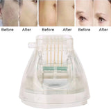 RF Microneedling Cartridges