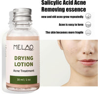 Acne Drying Lotion - Spot Treatment