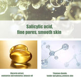 Acne Drying Lotion - Spot Treatment