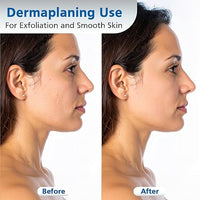 Swann Morton - Number #10R Dermaplaning Blades (Butter Blades)