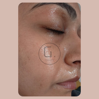 Grandeur Global Hyaluronic Acid Serum - Low molecular weight hyaluronic acid serum. Hydrated plump skin using Hyaluronic acid serum
