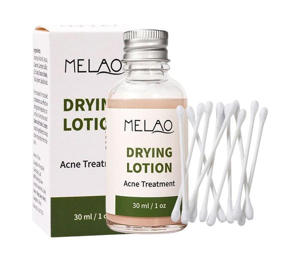 Acne Drying Lotion - Spot Treatment