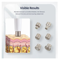 Benefits of diamond microdermabrasion