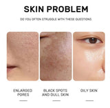 Glycolic Acid 7% Toning Resurfacing Solution Acne Cleanser Fades Dark Spots