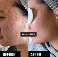 Zcosmo Algae Peel Trial Kit with Official Training