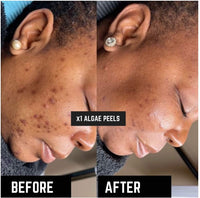 Zcosmo Algae Peel Trial Kit with Official Training