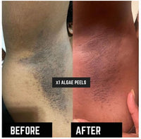 Zcosmo Algae Peel Trial Kit with Official Training