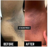 Zcosmo Algae Peel Trial Kit with Official Training