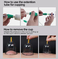 How to do Hijama Cupping?