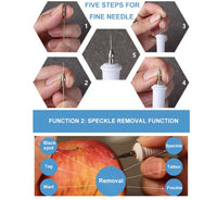 Skin tag removal machine