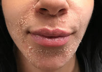 14% Jessner Chemical Peel for Professional Use - pH 1.9