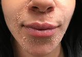 14% Jessner Chemical Peel for Professional Use - pH 1.9