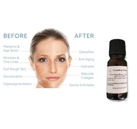 Alpha Beta Blend Chemical Peel (Professional Use) - pH 2.2
