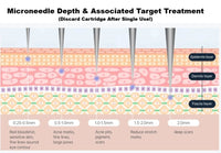 Diagram of microneedle depth and associated target treatment layers. Depth of microneedle and what skin concerns it targets. Targeted treatments for microneedling. Depth of microneedling and what it means. 