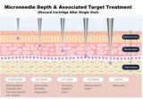 Diagram of microneedle depth and associated target treatment layers. Depth of microneedle and what skin concerns it targets. Targeted treatments for microneedling. Depth of microneedling and what it means. 