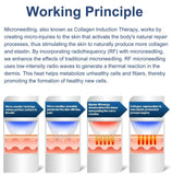 how does RF Microneedling work on the skin