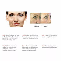 How to use the Drs 140 dermastamp