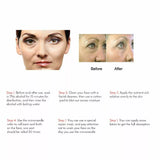 How to use the Drs 140 dermastamp