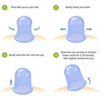 Silicone Cupping Set