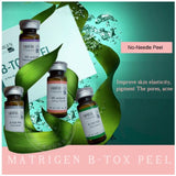 Matrigen B-Tox Peel (Herbal Peel/No Needle)