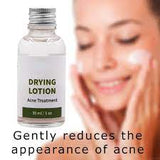 Melao Drying Lotion (Anti-Acne-30ml)
