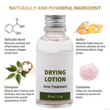 Melao Drying Lotion (Anti-Acne-30ml)