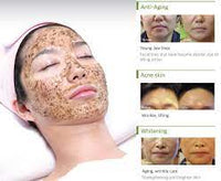 Matrigen B-Tox Peel (Herbal Peel/No Needle)