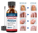 Lanthome Nail Treatment Serum - Anti-Fungal Nail Renewal Ointment - Organic Nail Fungal/Repair Treatment (10ml)