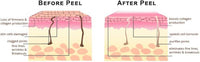 Cosmetic Grade 70% Glycolic Acid Peel Concentrate (30ml)