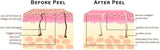 Cosmetic Grade 70% Glycolic Acid Peel Concentrate (30ml)