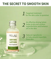 Melao Drying Lotion (Anti-Acne-30ml)