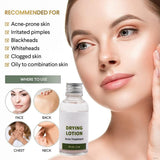 Melao Drying Lotion (Anti-Acne-30ml)
