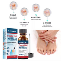 Lanthome Nail Treatment Serum - Anti-Fungal Nail Renewal Ointment - Organic Nail Fungal/Repair Treatment (10ml)