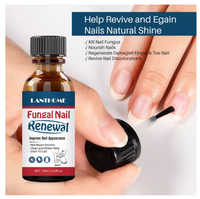 Lanthome Nail Treatment Serum - Anti-Fungal Nail Renewal Ointment - Organic Nail Fungal/Repair Treatment (10ml)